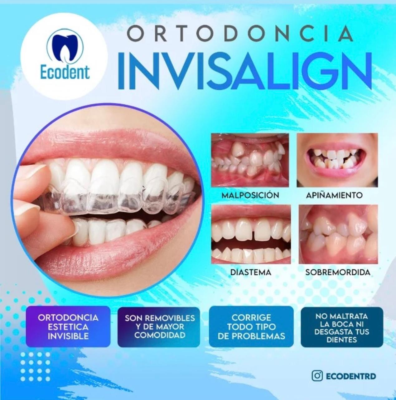Caso de ortodoncia, foto 1