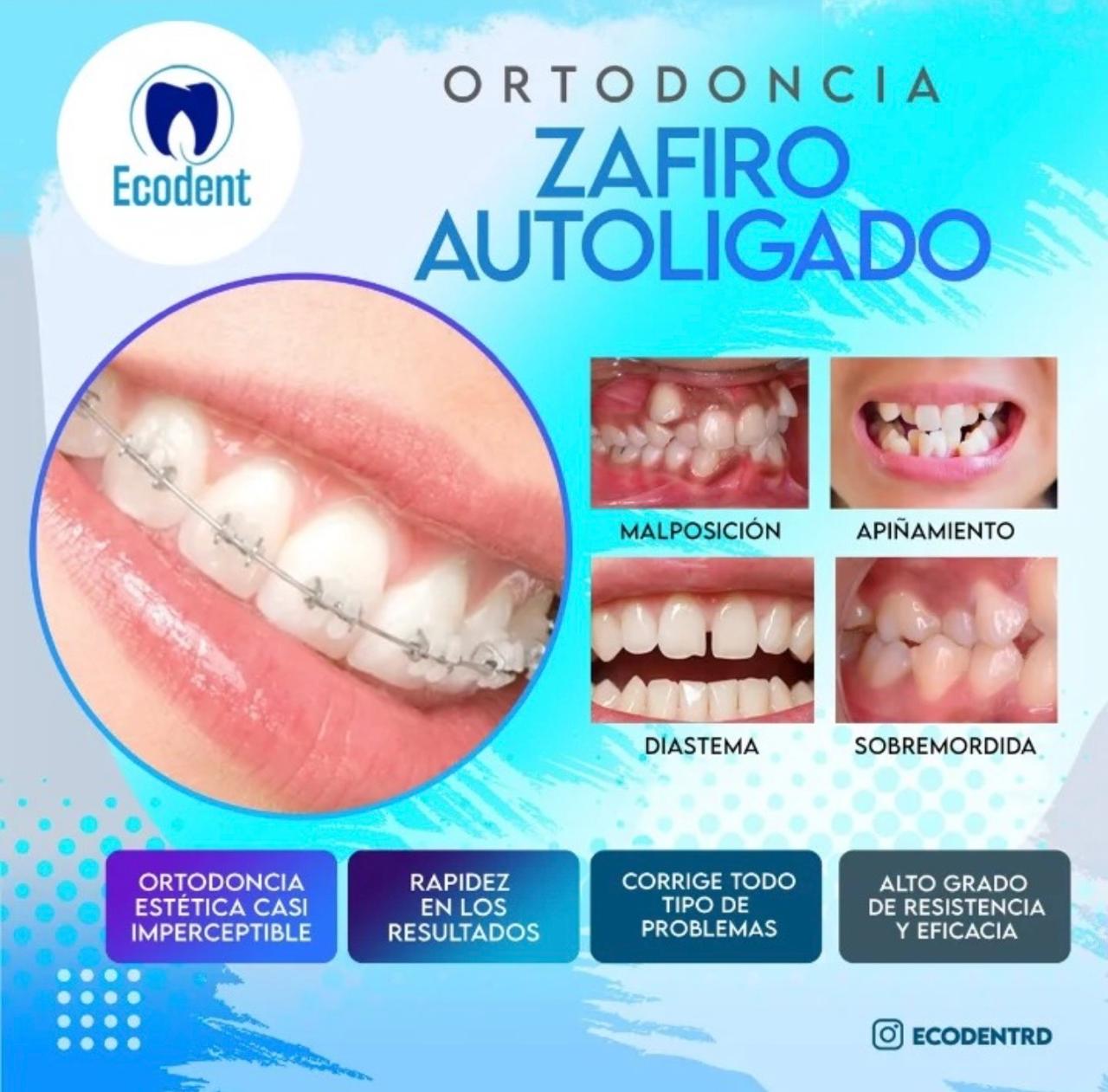Caso de ortodoncia, foto 2