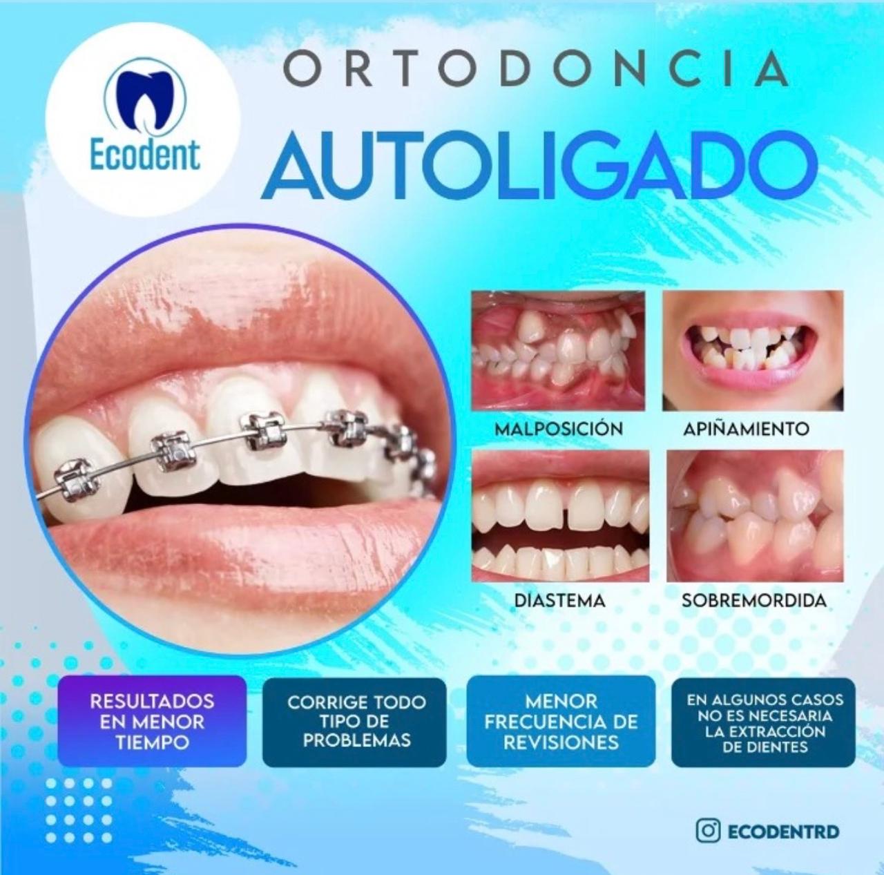Caso de ortodoncia, foto 3