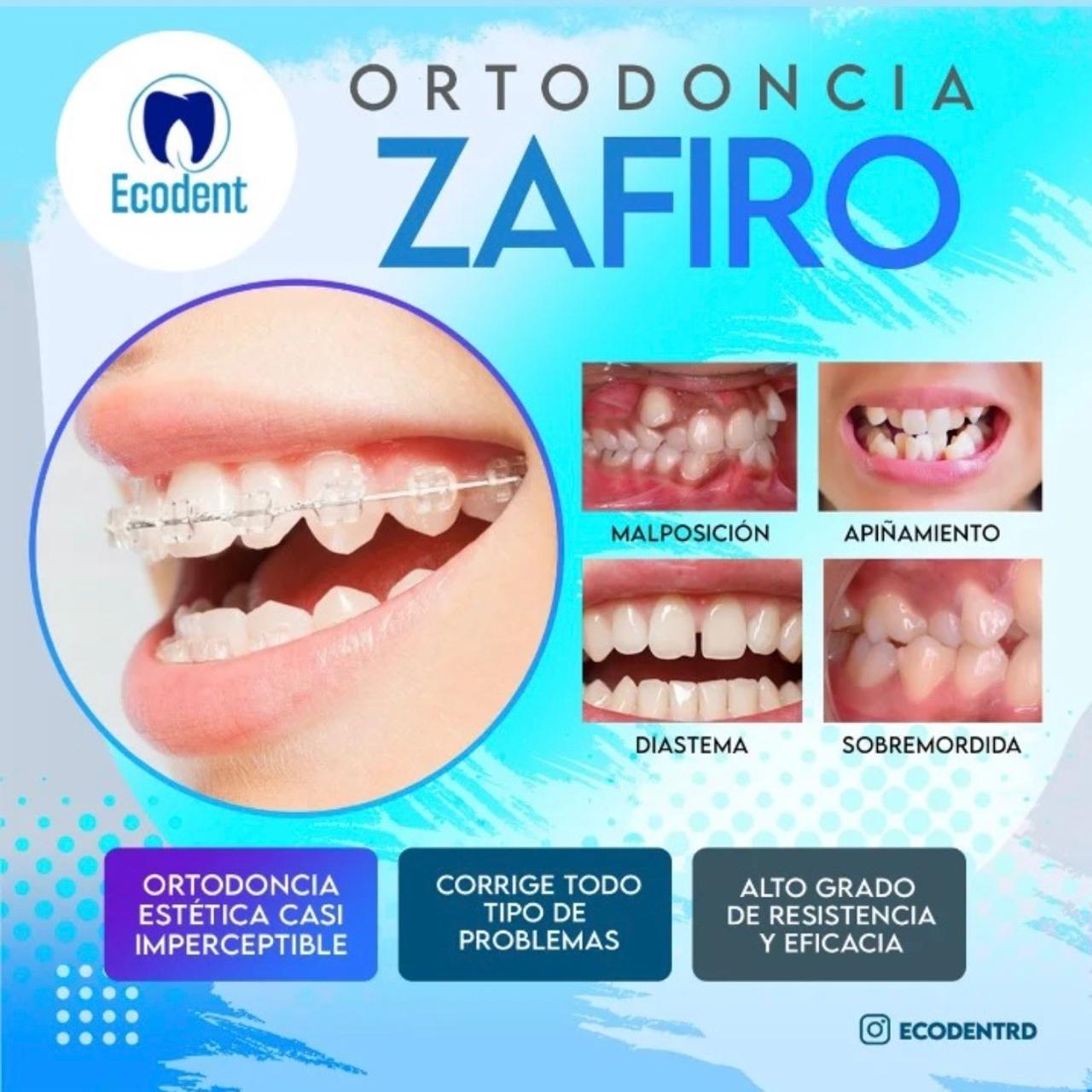 Caso de ortodoncia, foto 4