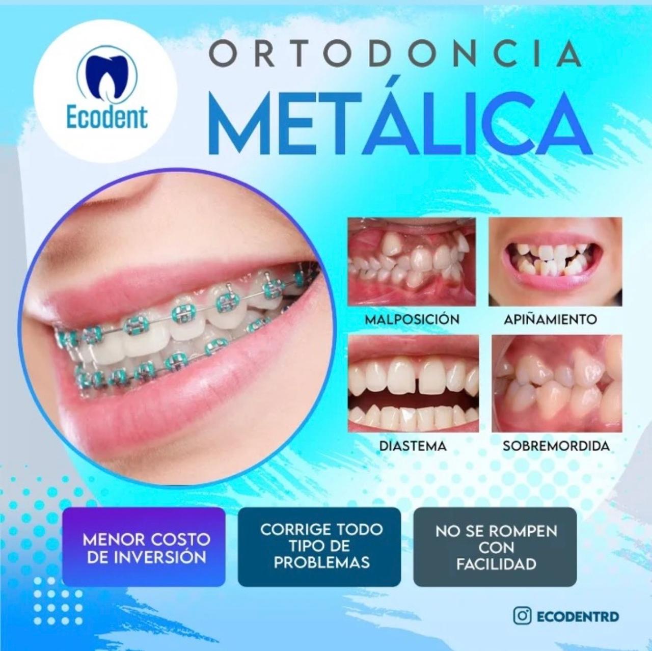 Caso de ortodoncia, foto 5